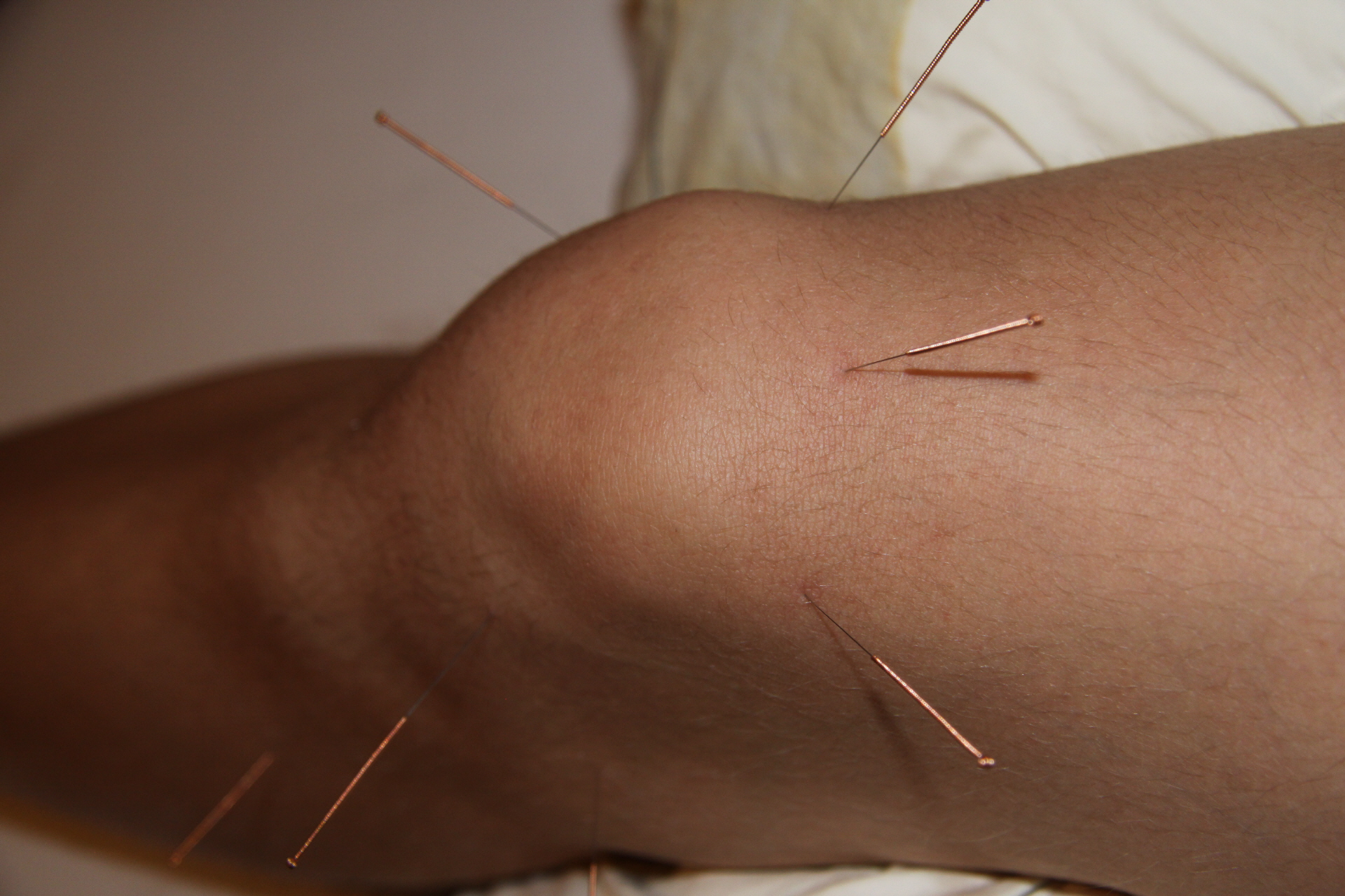 Naturheilpraxis Akuvital